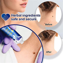 Load image into Gallery viewer, Wart Remover Ointment Cream
