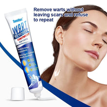 Load image into Gallery viewer, Wart Remover Ointment Cream
